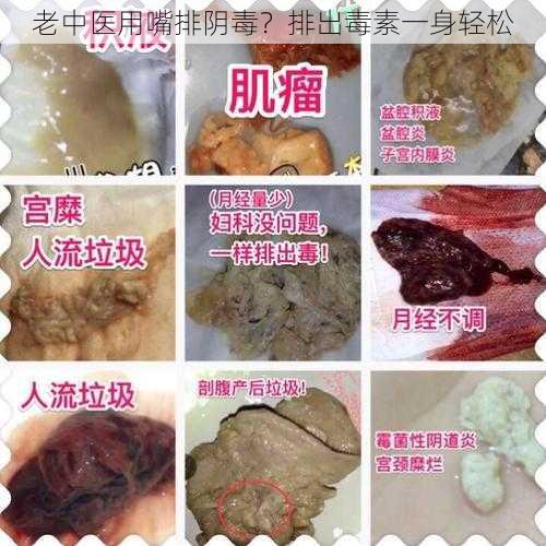 老中医用嘴排阴毒？排出毒素一身轻松