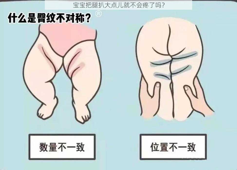 宝宝把腿扒大点儿就不会疼了吗？